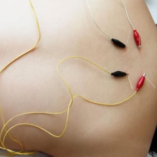 Electro acupuncture CPD Electro-Acupuncture