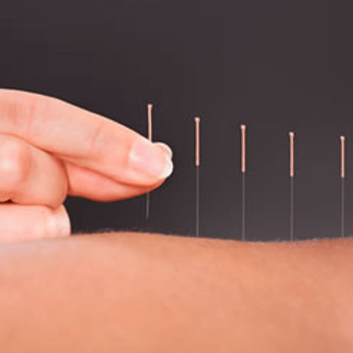 TCM-Acupuncture-Diploma TCM Acupuncture Diploma