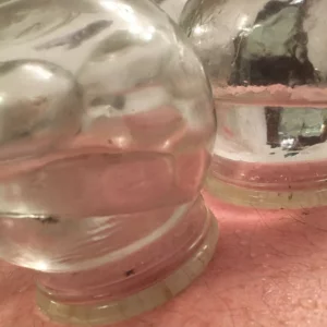 Advanced Fire Cupping