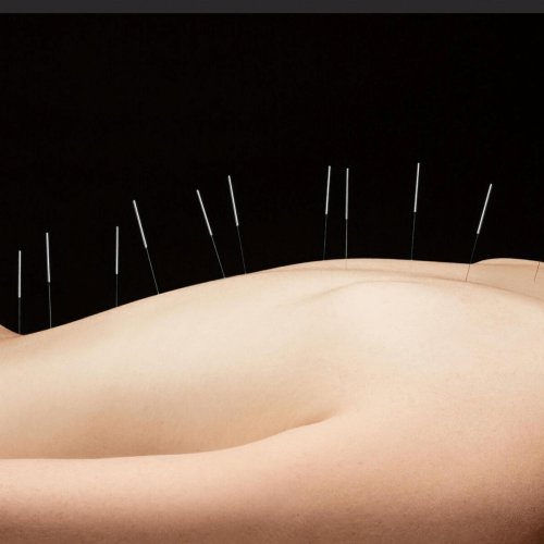 back and cautionary needling Back and Cautionary Needling