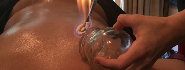 Chinese Fire Cupping