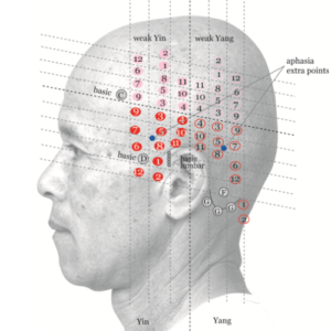 Yamamoto New Scalp Acupuncture Access your YNSA Neck Diagnosis CPD