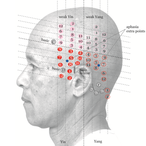 Yamamoto New Scalp Acupuncture Online: YNSA - Using the Abdomen for Diagnosis