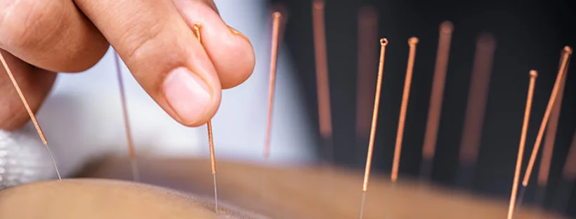 Why Choose our Acupuncture Course