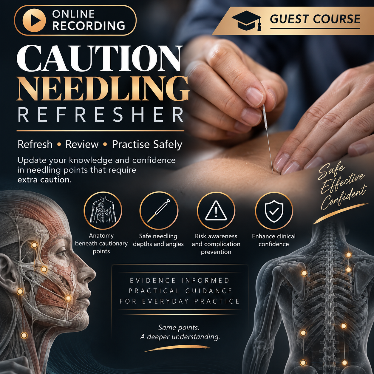 Online: Caution Needling Refresher